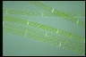 Spirogyra