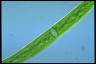 Closterium intermedium