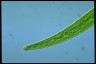 Closterium intermedium