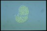 Microcystis