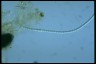 Anabaena cylindrica