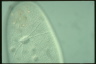 Paramecium