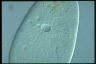 Paramecium