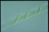 Spirogyra