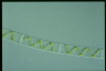 Spirogyra