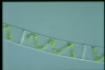 Spirogyra