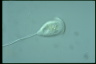 Vorticella