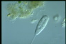 Vorticella