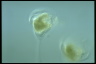 Vorticella