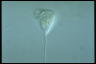 Vorticella