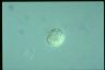 Acanthocystis turfacea