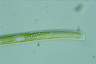 Nitzschia sigmoidea