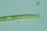 Nitzschia sigmoidea