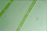 Spirogyra distenta