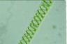 Spirogyra distenta