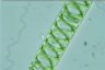 Spirogyra distenta