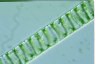 Spirogyra