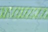 Spirogyra pulchrifigurata