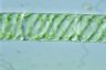 Spirogyra pulchrifigurata