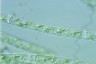 Spirogyra