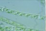 Spirogyra