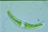 Closterium leibleinii