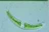 Closterium leibleinii