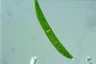 Closterium intermedium