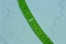 Closterium intermedium