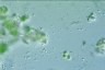 Apatococcus lobatus