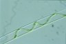 Spirogyra