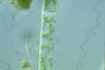 Spirogyra