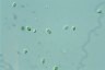 Oocystis