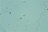 Oocystis