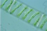 Spirogyra