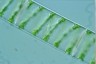 Spirogyra