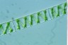 Spirogyra