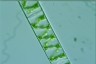 Spirogyra