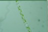 Spirogyra