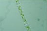 Spirogyra