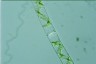 Spirogyra