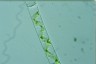 Spirogyra