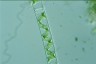 Spirogyra