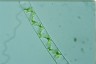 Spirogyra