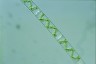 Spirogyra