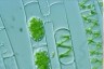 Spirogyra