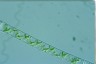 Spirogyra arta