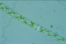 Spirogyra arta