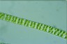 Spirogyra