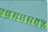 Spirogyra